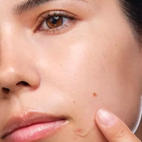 Congestion skin concern